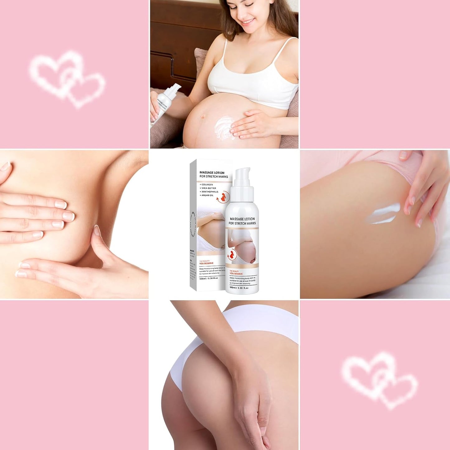 Stretch Mark Cream for Pregnancy - Brightening and Moisturizing with Collagen and Avocado Extract - Promotes Skin Elasticity and Fades Postpartum Stretch Marks - for Use on The Tummy, HIPS - 3.38 oz