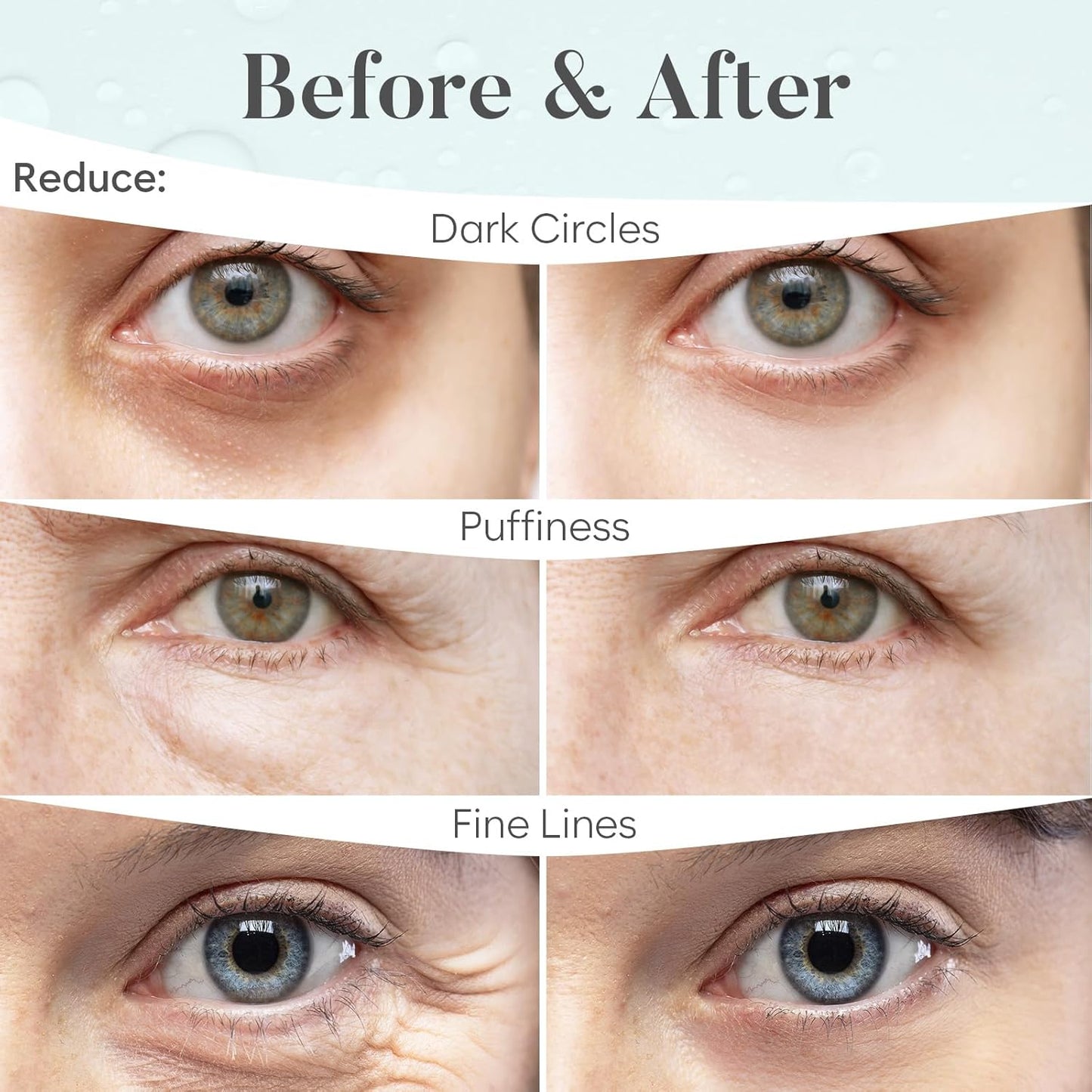 Hyaluronic Acid Eye Patches (30 Pairs) Eye Mask | Eye Masks with Niacinamide & Hyaluronic Acid | Under Eye Patches for Dark Circles | Under Eye Patches for Puffy Eyes | Eye Care