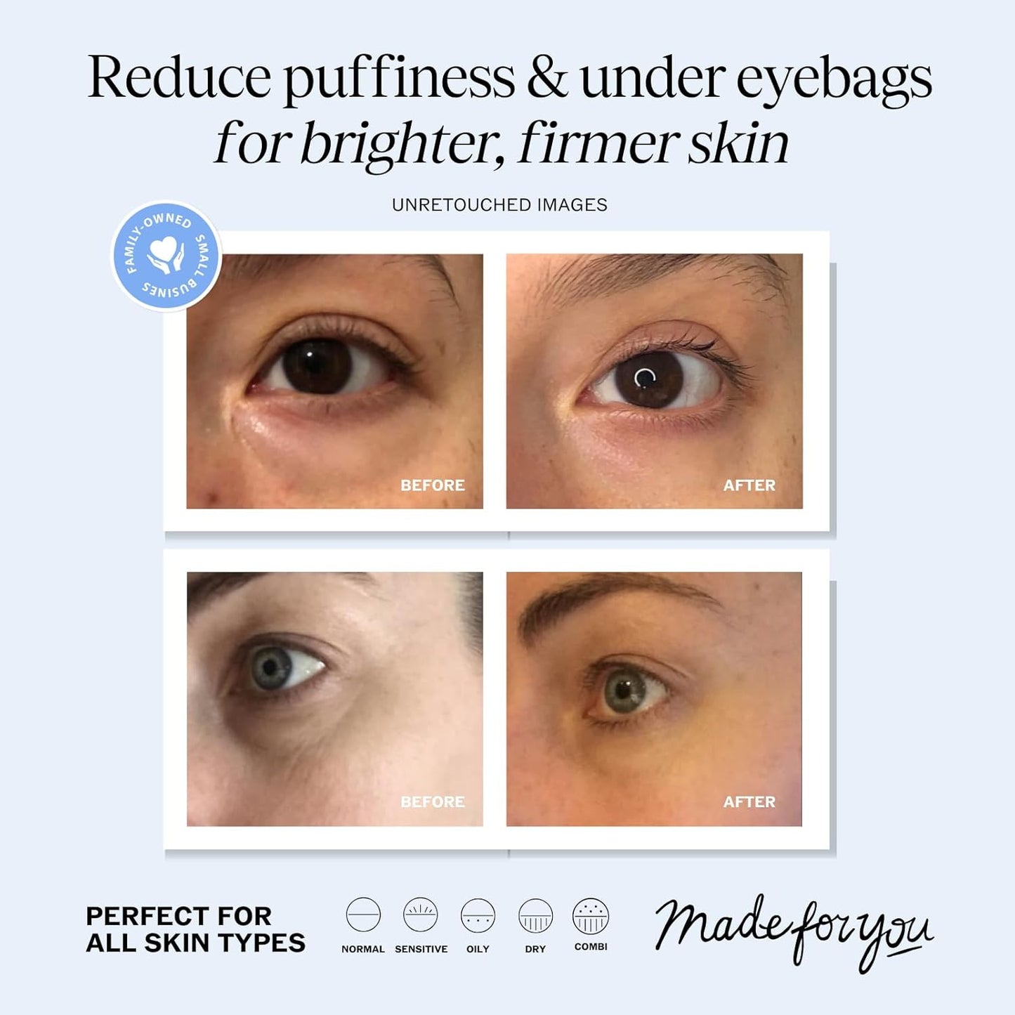 LilyAna Naturals Eye Cream for Dark Circles and Puffiness, Under Eye Cream for Wrinkles and Bags, Anti Aging Eye Cream helps Improve Dryness and Sensitive Skin - 1 oz - Made in USA