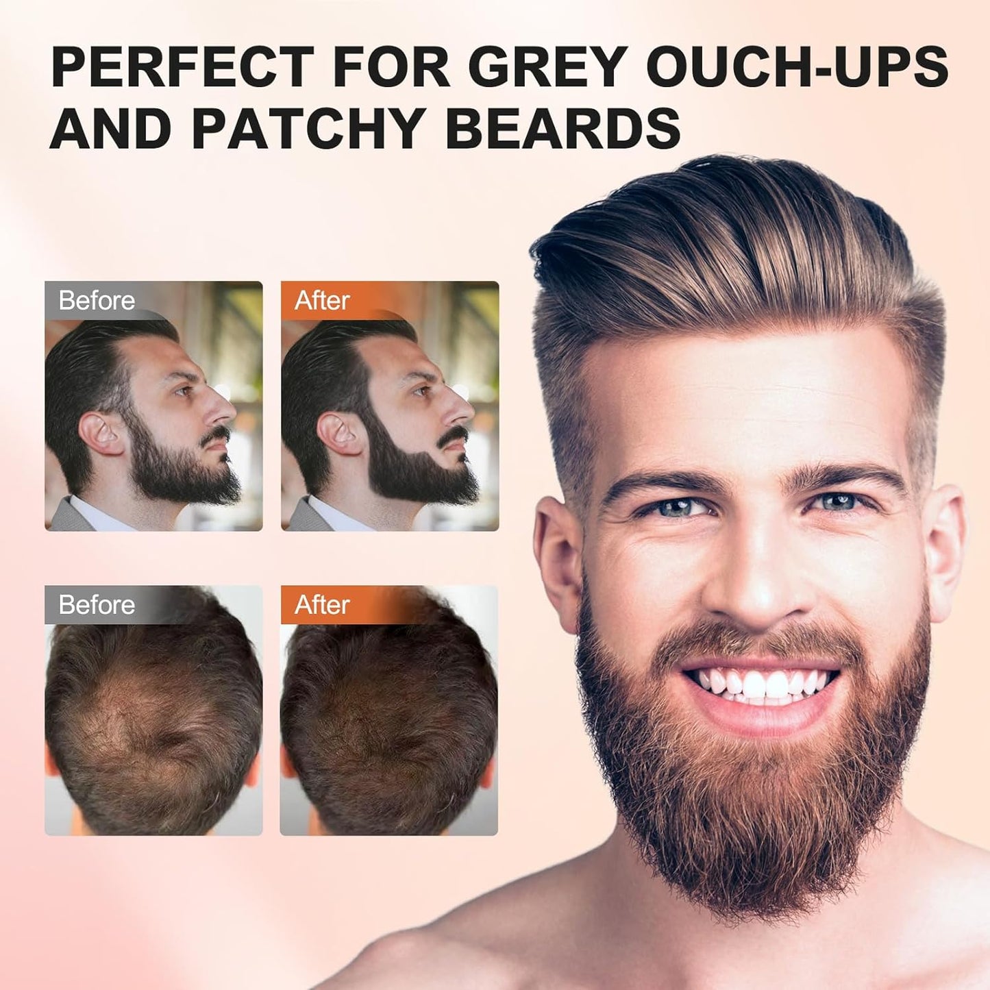 Root Touch Up Hair Powder, Med Blonde, Instantly Covers Hairline Shadow, Thinning Hair for Women Eyebrows, Gray Hair Coverage for Men's Beard Line, Bald Spots