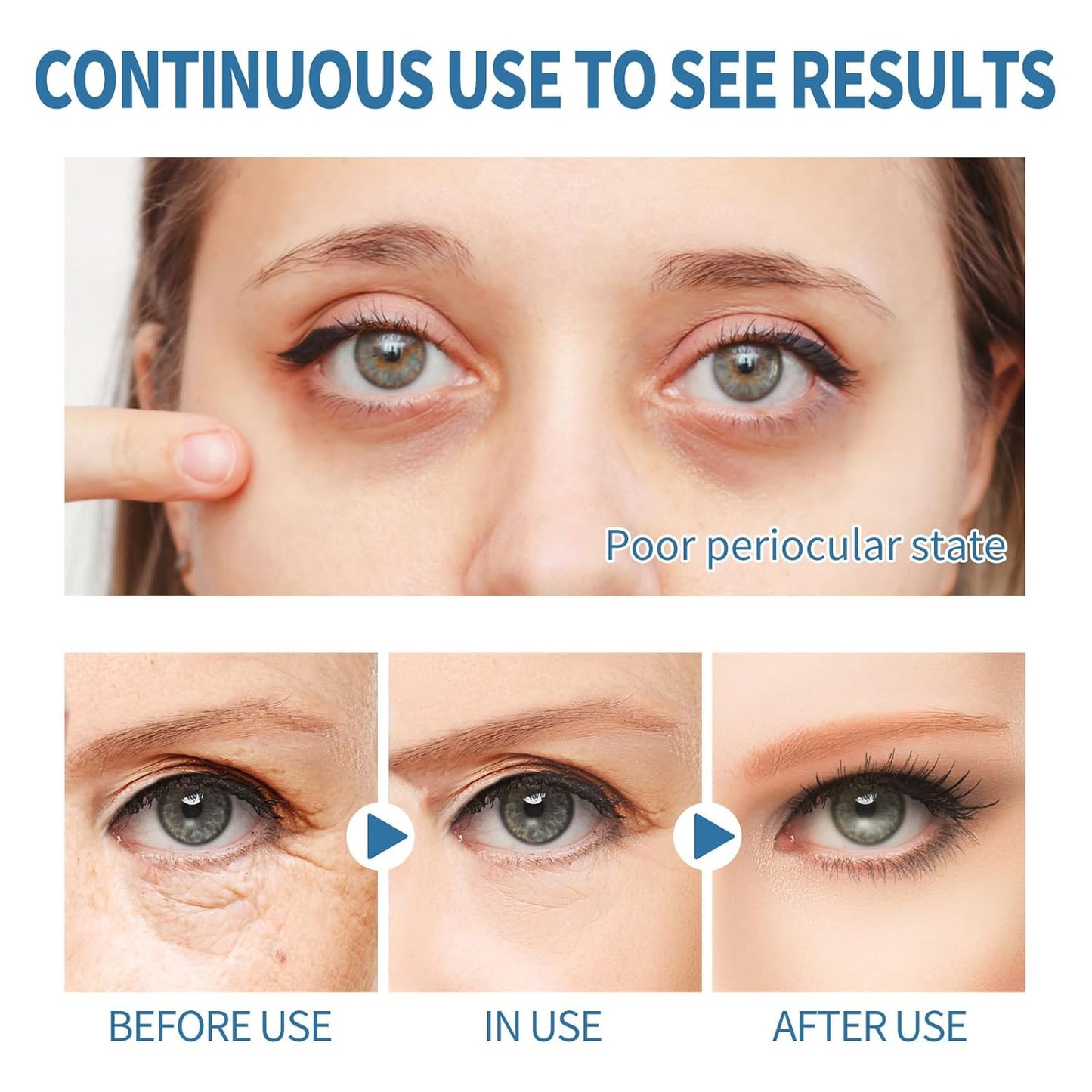 Anti-Aging Under Eye Patches Strong Adhesion Eye Patches for Puffy Eyes and Dark Circles Deep Hydration Eye Gel Pads with Marine Collagen Hyaluronic Acid and Pearl Extract,6 Pairs
