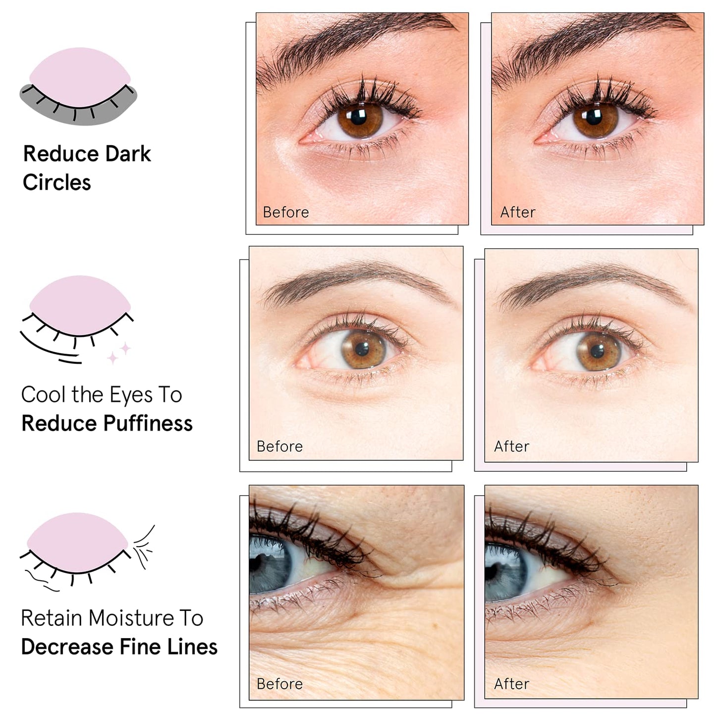 grace & stella Award Winning Under Eye Mask (Pink, 24 Pairs) Reduce Dark Circles, Puffy Eyes, Undereye Bags, Wrinkles - Gel Under Eye Patches - Birthday Gifts for Women - Vegan Cruelty-Free Self Care
