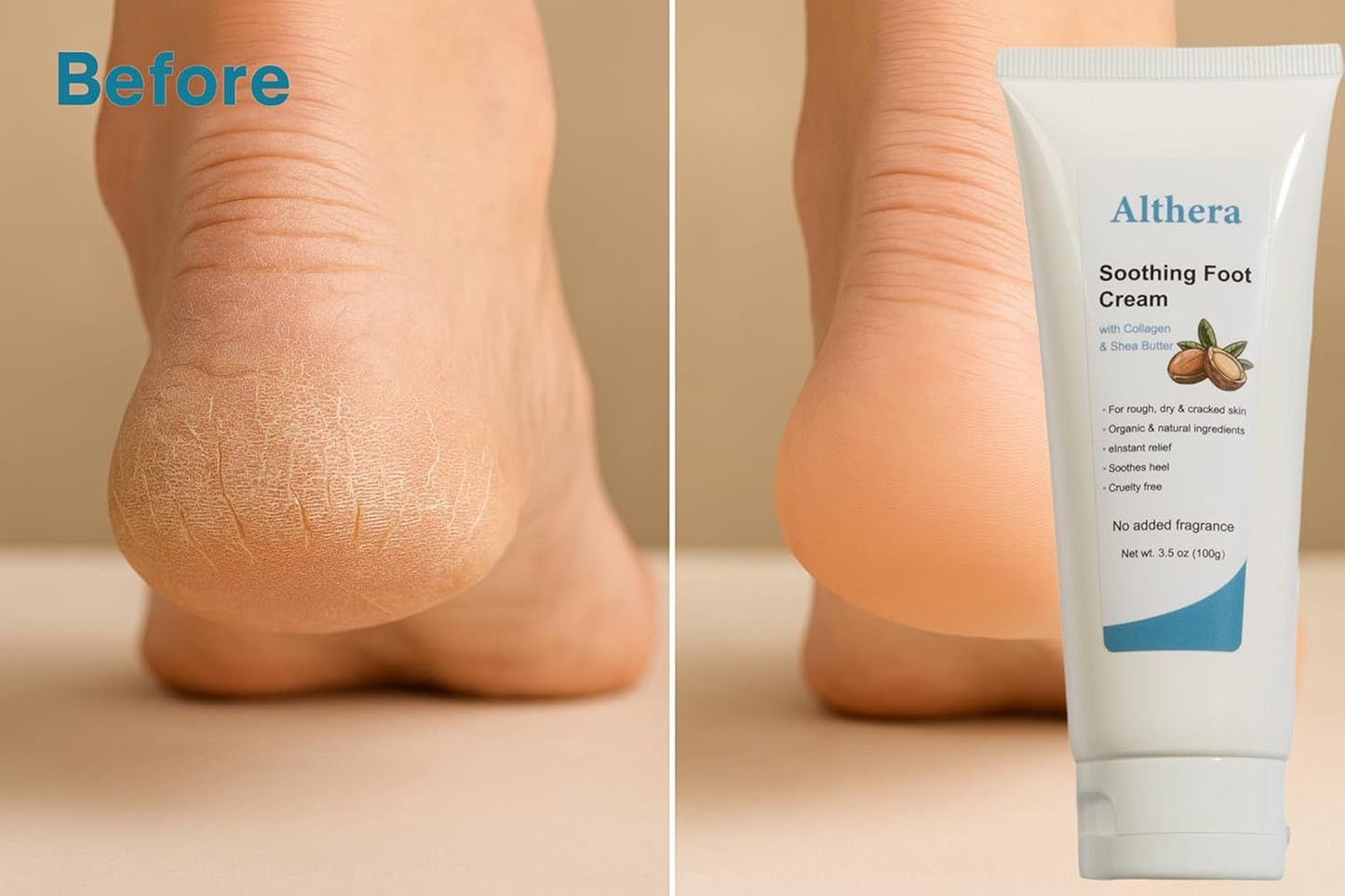 soothing Foot Cream with Collagen, Lactic Acid, Urea & Shea Butter – 3.5oz Intensive Repair for Dry Cracked Heels, Includes Moisturizing Sock for Overnight Hydration (full sock)