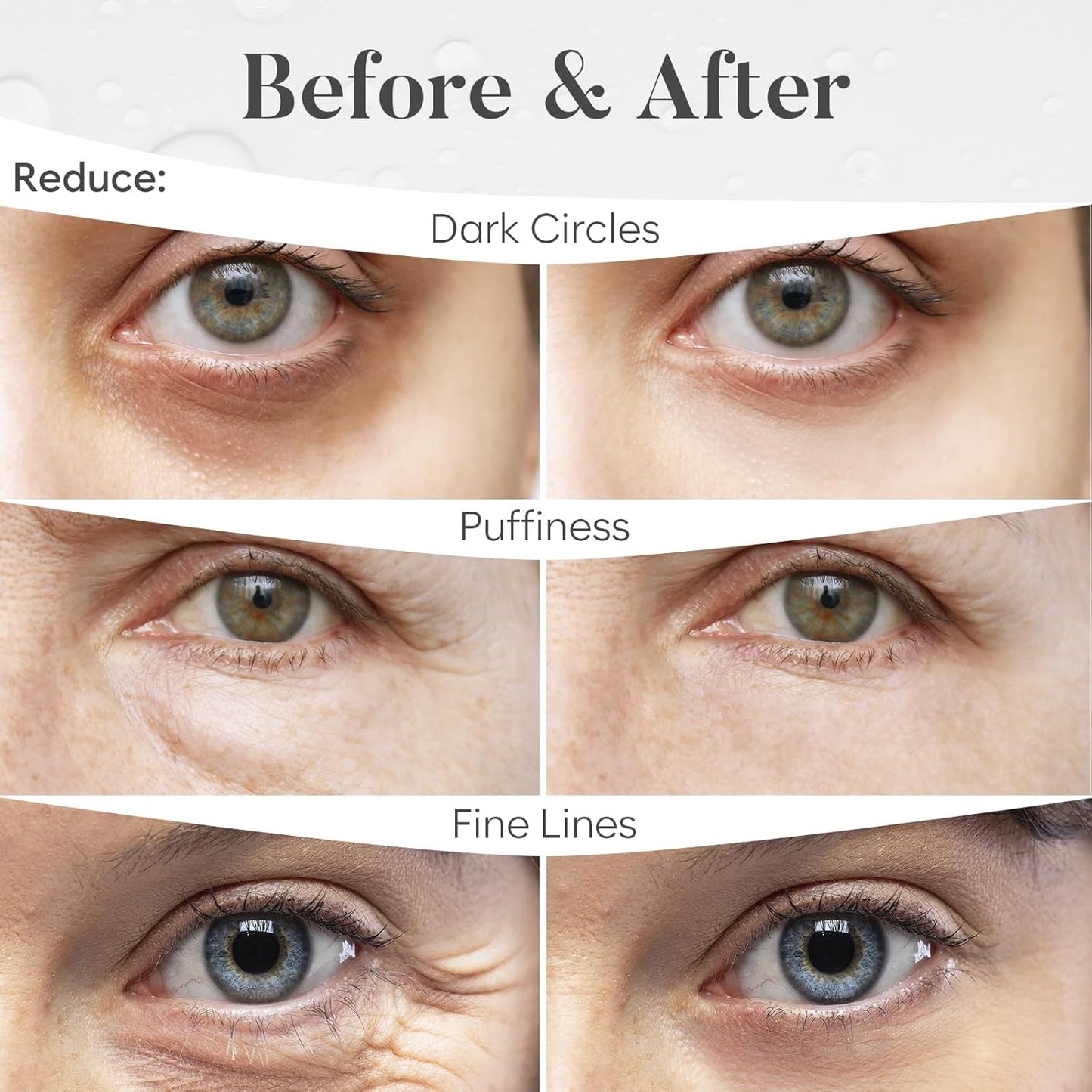Variety Under Eye Patches (30 Pairs) | Eye Mask with Niacinamide & Hyaluronic Acid | Under Eye Patches for Dark Circles & Puffiness | Eye Masks for Eye Care