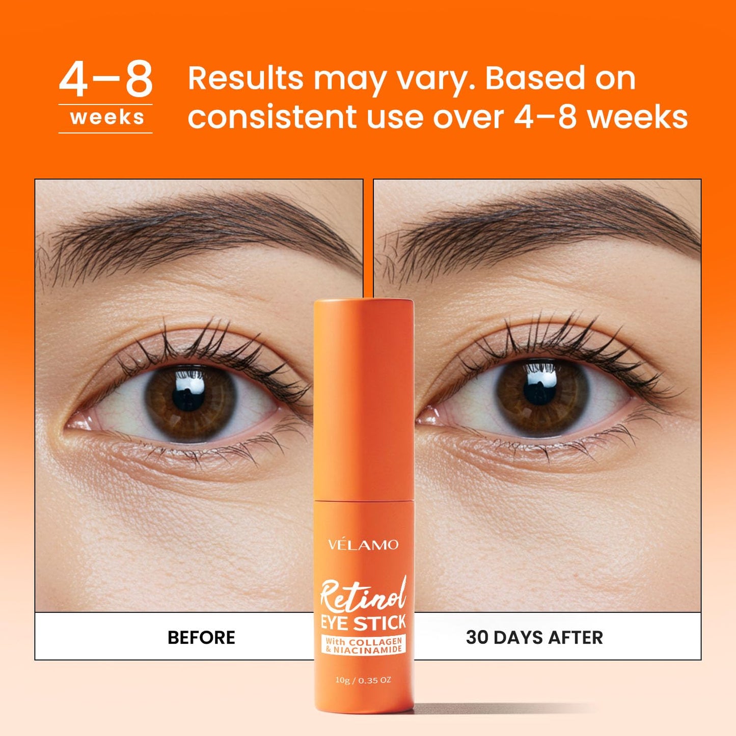 VELAMO ADVANCED Retinol Eye Balm Stick: Made in Korea, Upgraded 8-IN-1 Formula with Collagen, Niacinamide & Peptides – Under Eye Cream for Dark Circles, Puffiness & Wrinkles, 0.35oz/10g