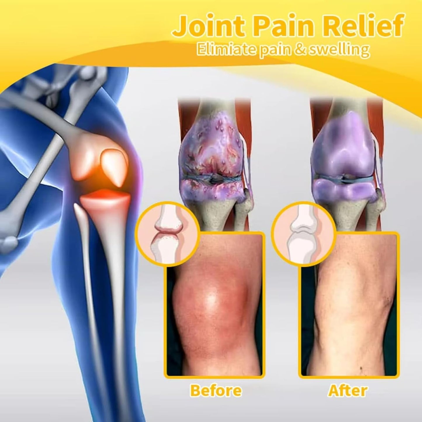 Botulinum Toxin & Bee Venom Pain-Relief Bone Healing Cream, 2025 New Bee Venom Cream for Arthritis, Bee Venom Joint Therapy Pain Relief Gel for Back, Knee, Hands, Neck, Feet, for All Skin Types(2PCS)