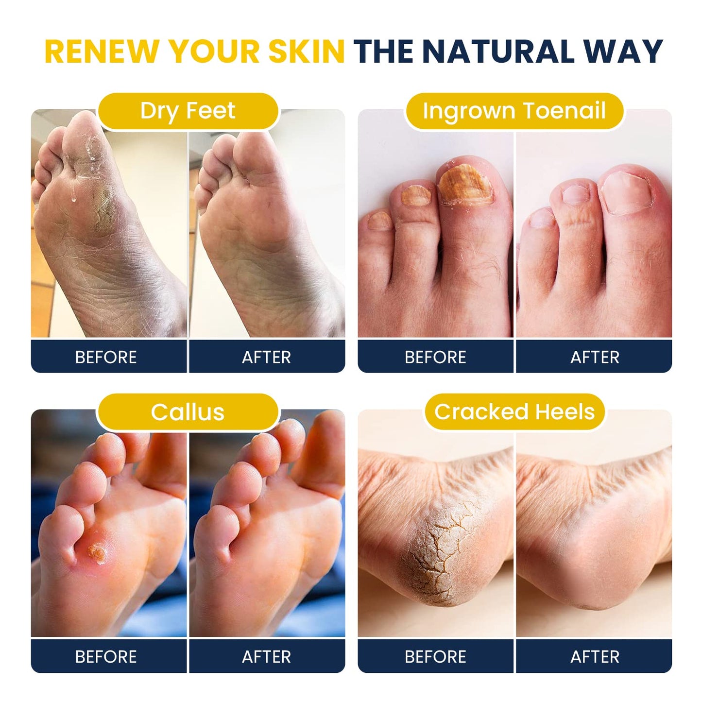 Citrus Detox Foot Soak With Epsom Salts - for Foot Callus, Immune Boost, Damaged Toenail, Athletes Foot, Pedicure and Soothes Tired Aching Feet - Made in USA 16 oz (Pack of 2)