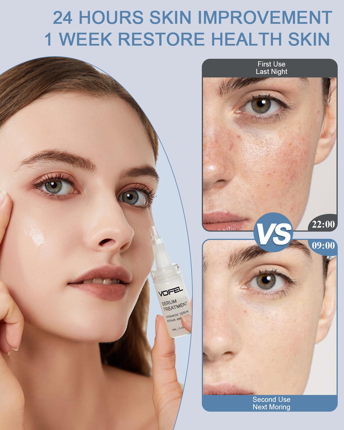 Ceramide Serum for Skin Barrier Repair, Hydrating Serum to Reduce Dryness and Wrinkles, 5% Ceramide Face Serum Ampoule Solution 2 Vials
