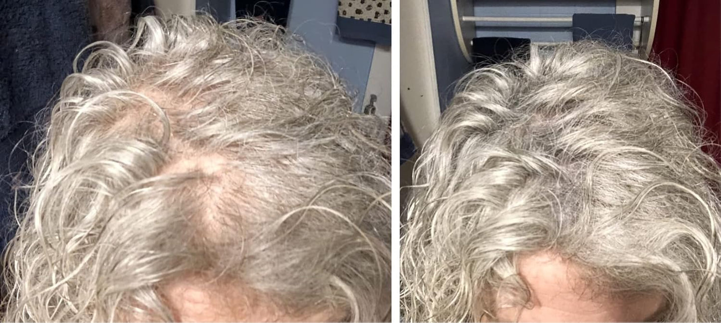 Caboki Hair Loss Concealer. All-Natural Hair Building Fiber. Make Thin Hair Look 10X Fuller Instantly. Eliminate the Appearance of Bald Spot and Thinning Hair (30G, 90-Day Supply). Gray