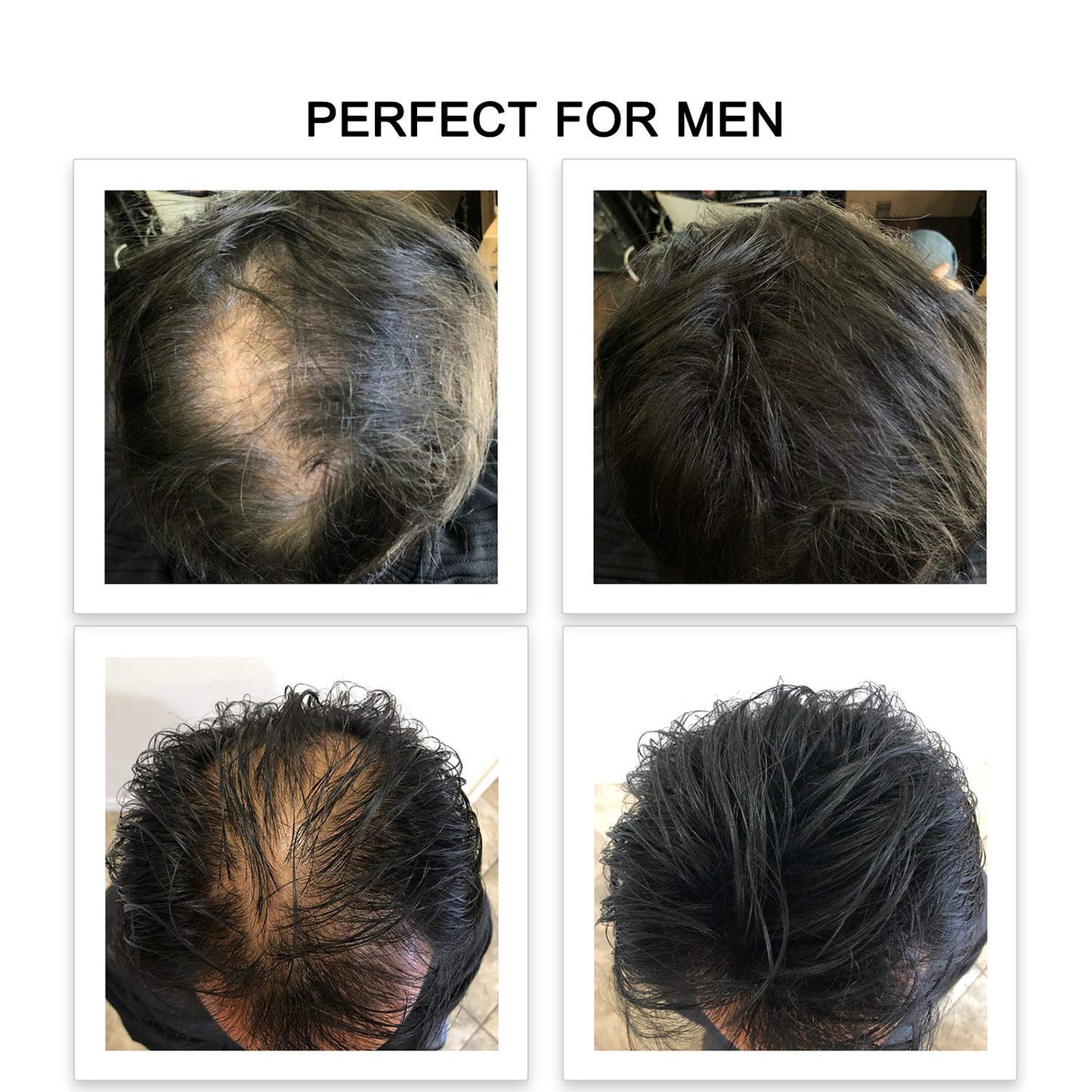 FEBRON Hair Fibers For Thinning Hair For Women & Men Hair Loss Concealer Hair Powder Volumizing Based 100% Undetectable & Natural - Bald Spots Filler (30 Gram, Dark Gray)