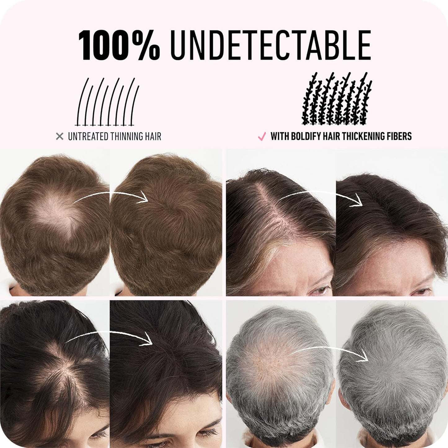 BOLDIFY Hair Fibers (28g) - Fill In Thinning and Fine Hair for an Instantly Fuller, Thicker Look - 14 Shades for Women & Men - Black