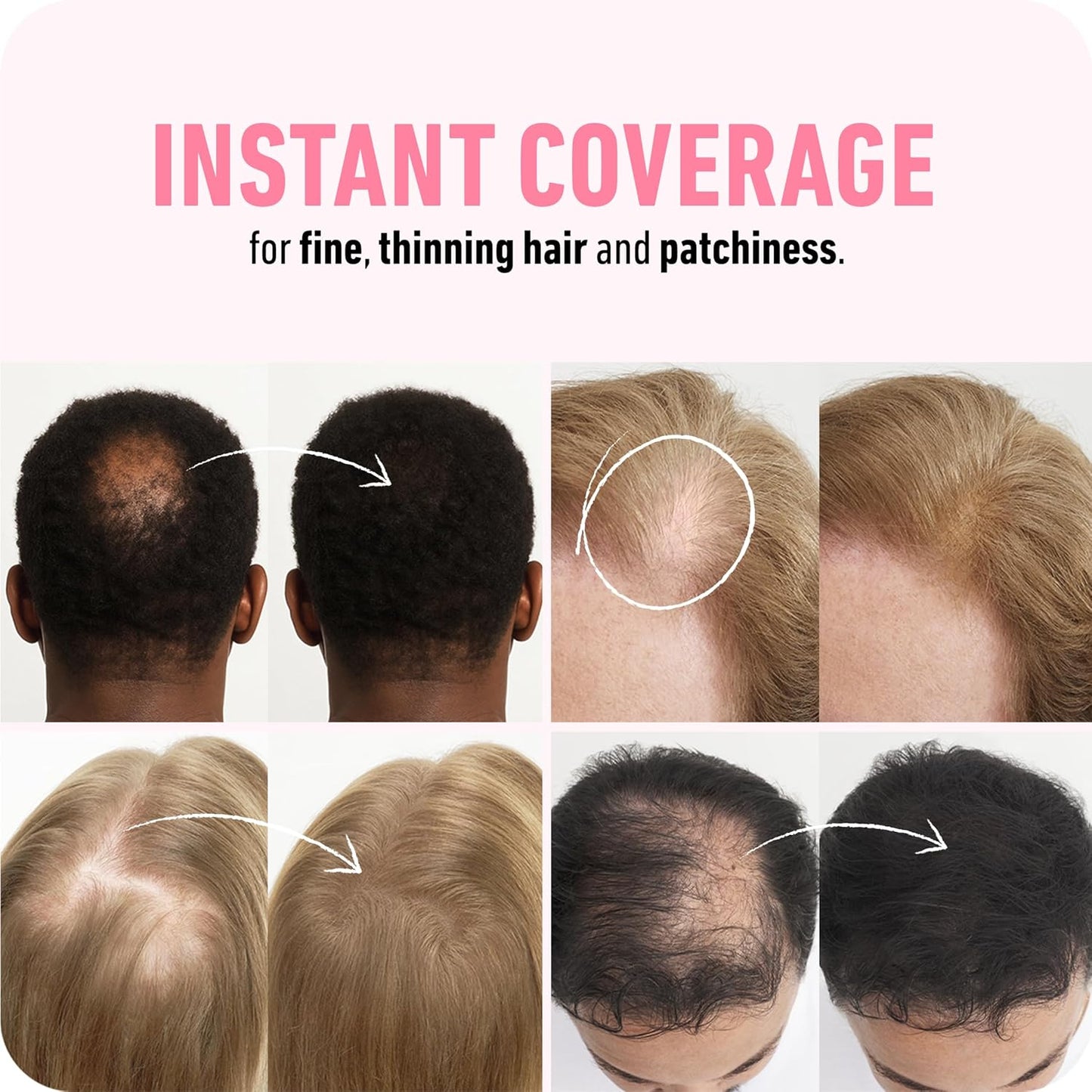 BOLDIFY Hair Fibers (56.5g) - Fill In Thinning and Fine Hair for an Instantly Fuller, Thicker Look - 14 Shades for Women & Men - Light Blonde