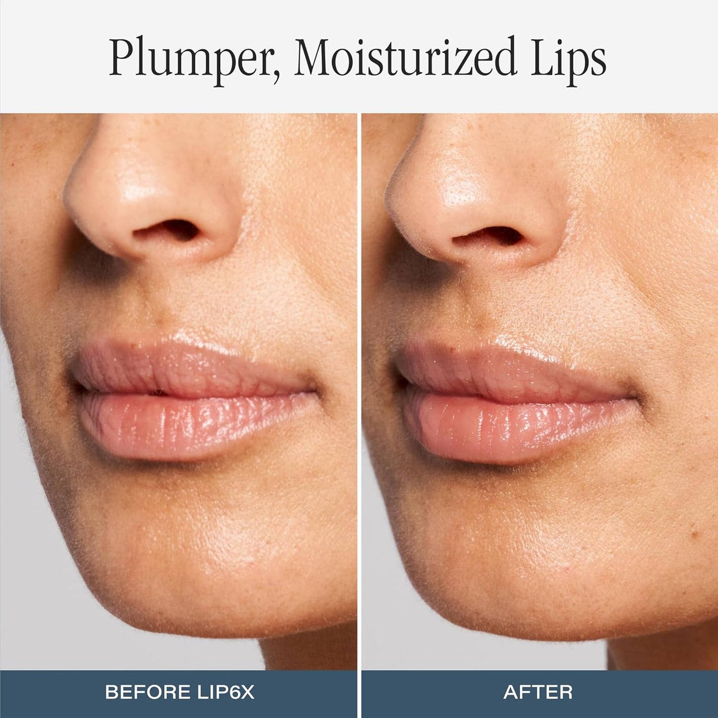 SKINN Lip Amplifying Serum, Lip6X with Peptides - Deep Moisturizing Serum Instantly Plumps, Hydrates & Smooths Lips & Boosts Collagen Production - Lip Care Products for Women