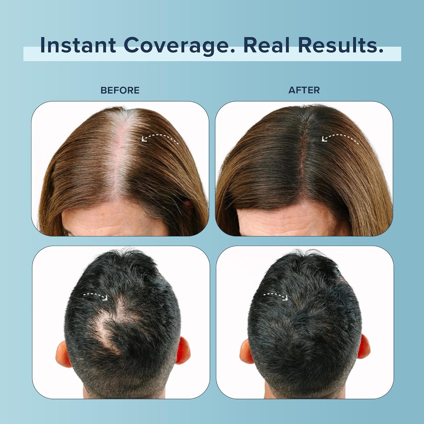 TRUHAIR Color Fibers Root Coverage & Density Booster | Quick-Apply Root Touch Up Hair Color | Natural Color Matching, Gray Hair Cover up to Color Gray Roots - 11 Hair Colors Available (Dark Brown)