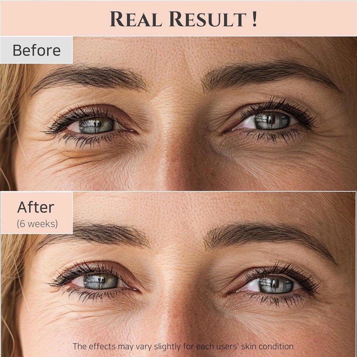 Beauty of Joseon Revive Eye Serum with Retinal Niacinamide Correction for Puffy Eye Bags Fine Lines Dark Circles Wrinkles, Korean Skin Care 30ml, 1 fl.oz